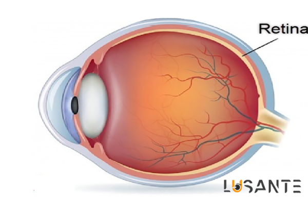 Retina;lusante