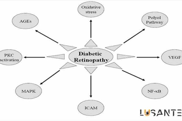 Symptoms of retinopathy ; lusante.com