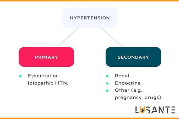 How to prevent hypertension; Primary hypertension treatment; lusante.com