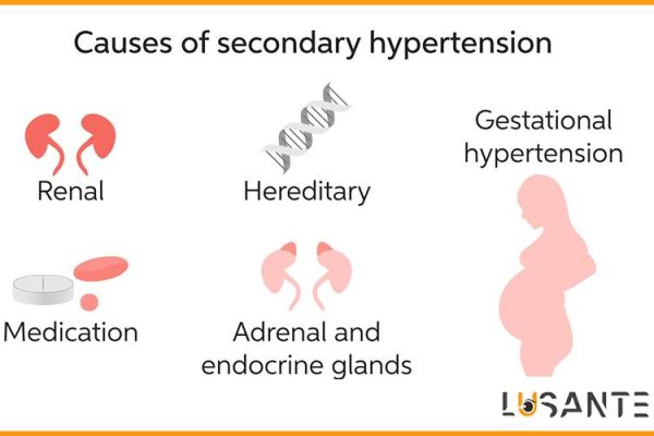 How to prevent hypertension; Treatment of secondary hypertension; lusante.com