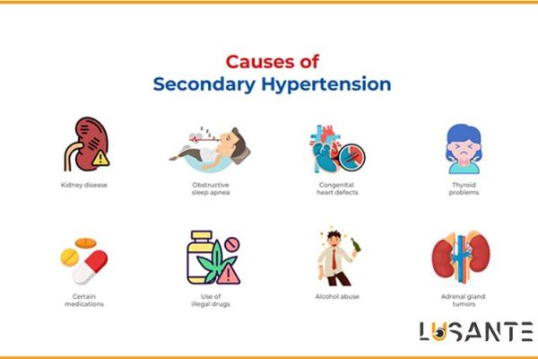 prevent hypertension; Secondary hypertension; lusante.com